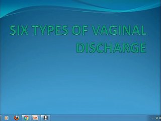 Six types of vaginal discharge--female vaginal discharge¦¦abnormal and abnormal discha